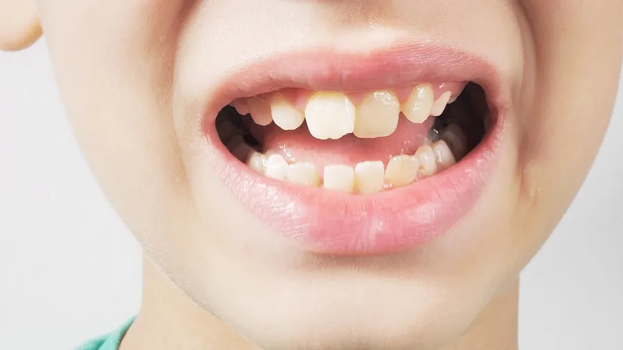 Emergency dental care