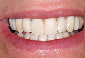 ToothDocs ToothDocs