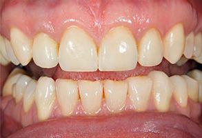 ToothDocs ToothDocs