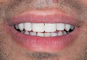 ToothDocs ToothDocs