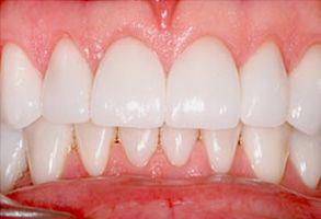 ToothDocs ToothDocs