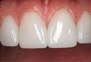 ToothDocs ToothDocs