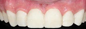 ToothDocs ToothDocs
