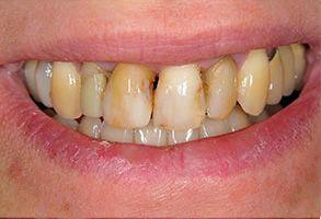 ToothDocs ToothDocs