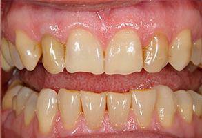 ToothDocs ToothDocs