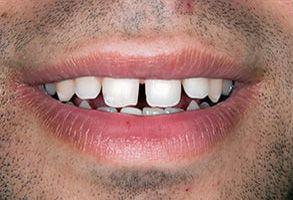 ToothDocs ToothDocs