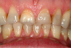 ToothDocs ToothDocs
