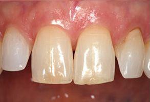 ToothDocs ToothDocs