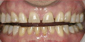 ToothDocs ToothDocs