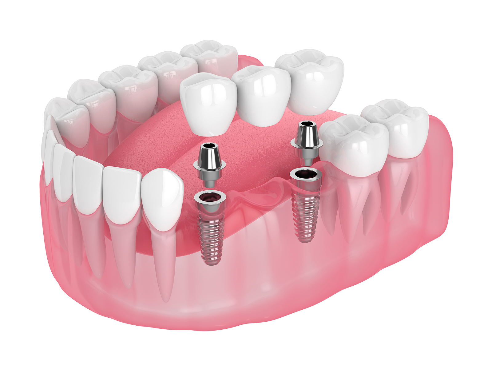 ToothDocs ToothDocs