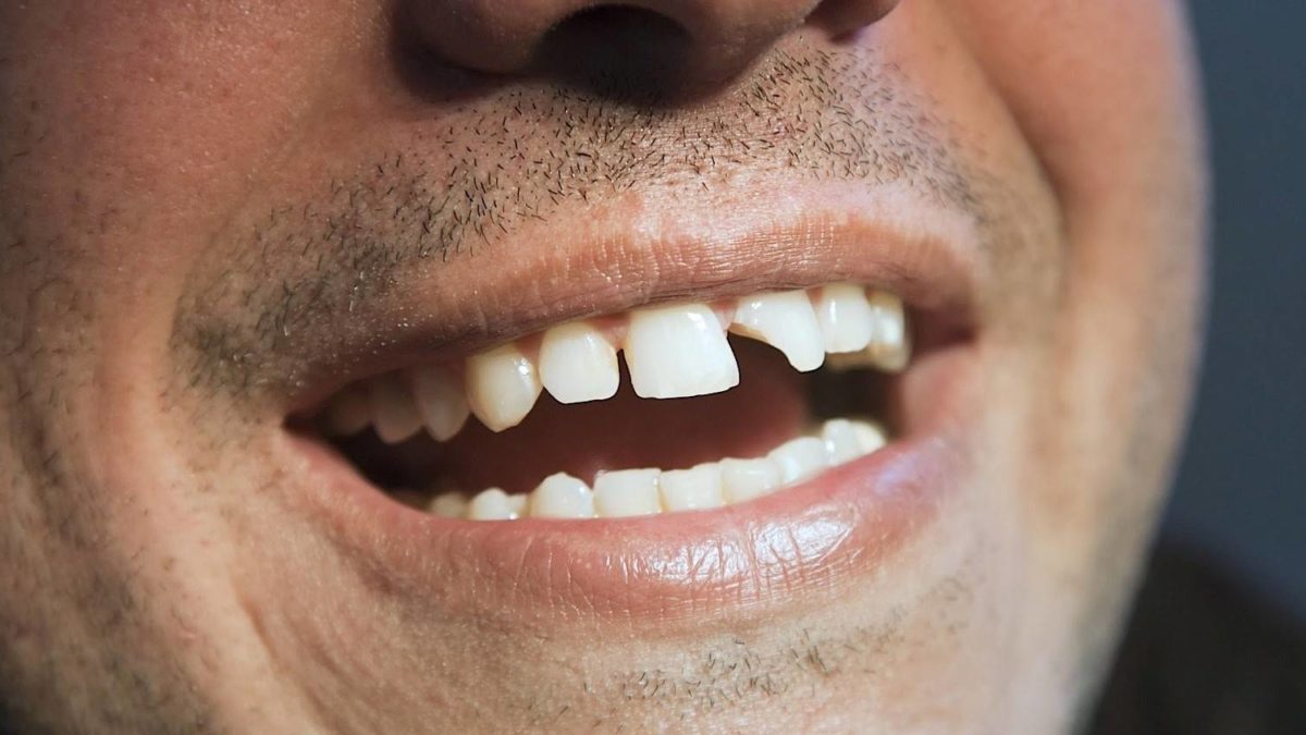 ToothDocs ToothDocs