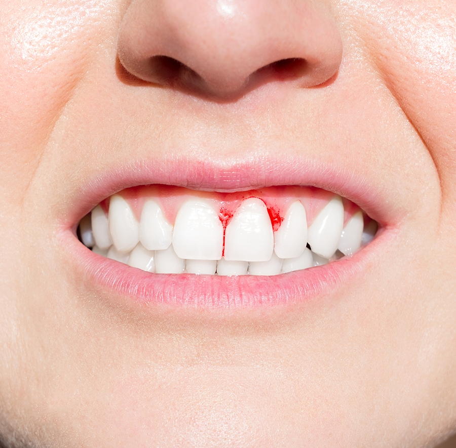 ToothDocs ToothDocs