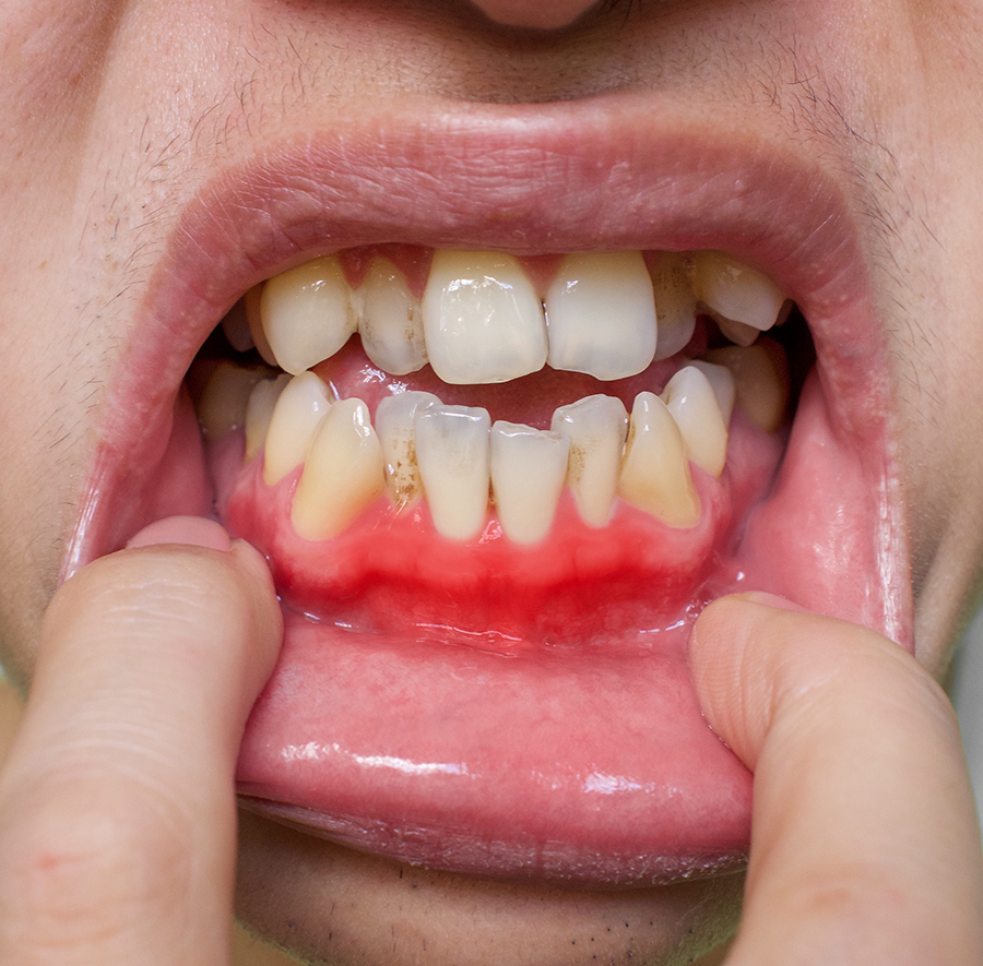 ToothDocs ToothDocs