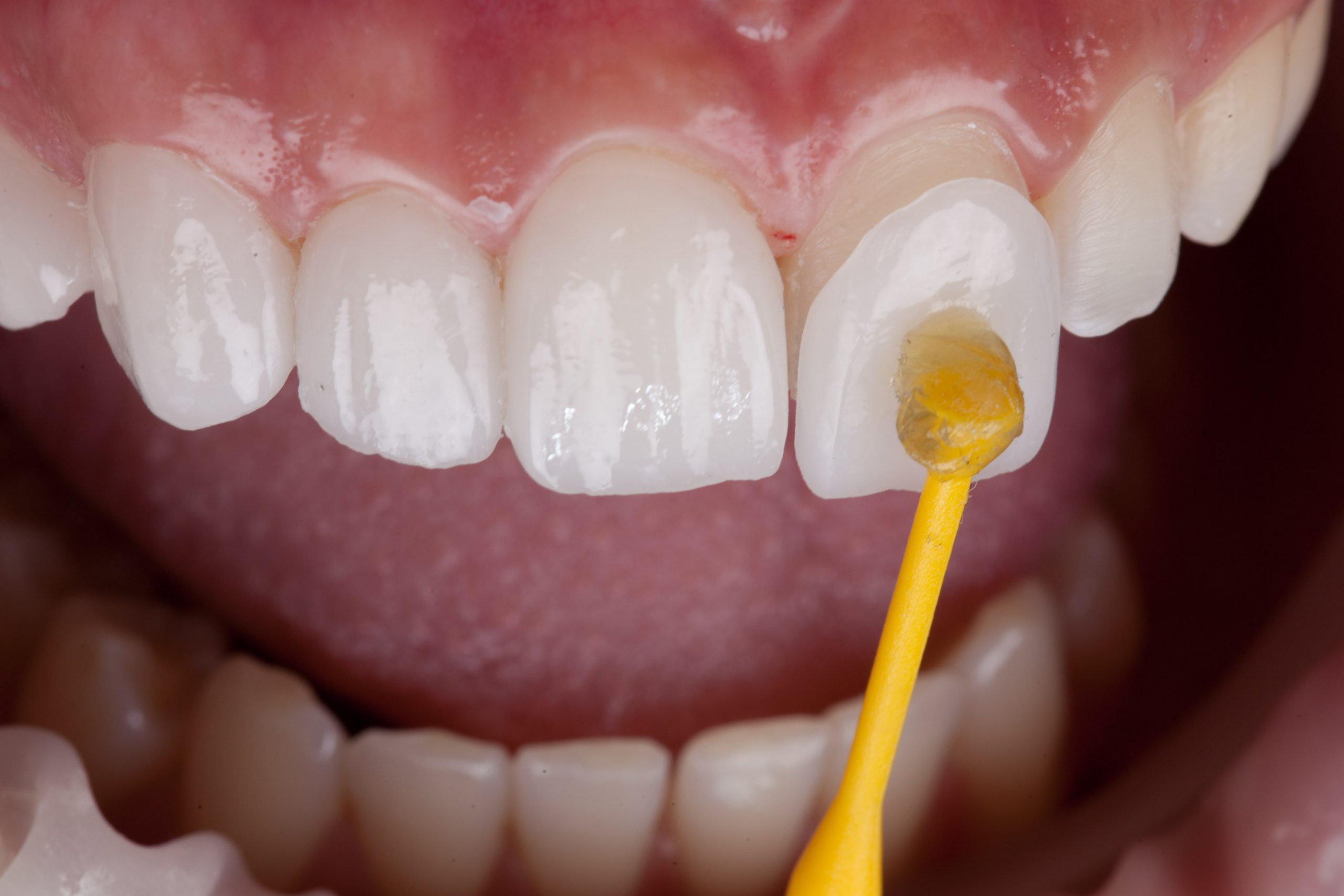 ToothDocs ToothDocs